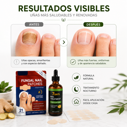 NailFix™ Kit Antihongos