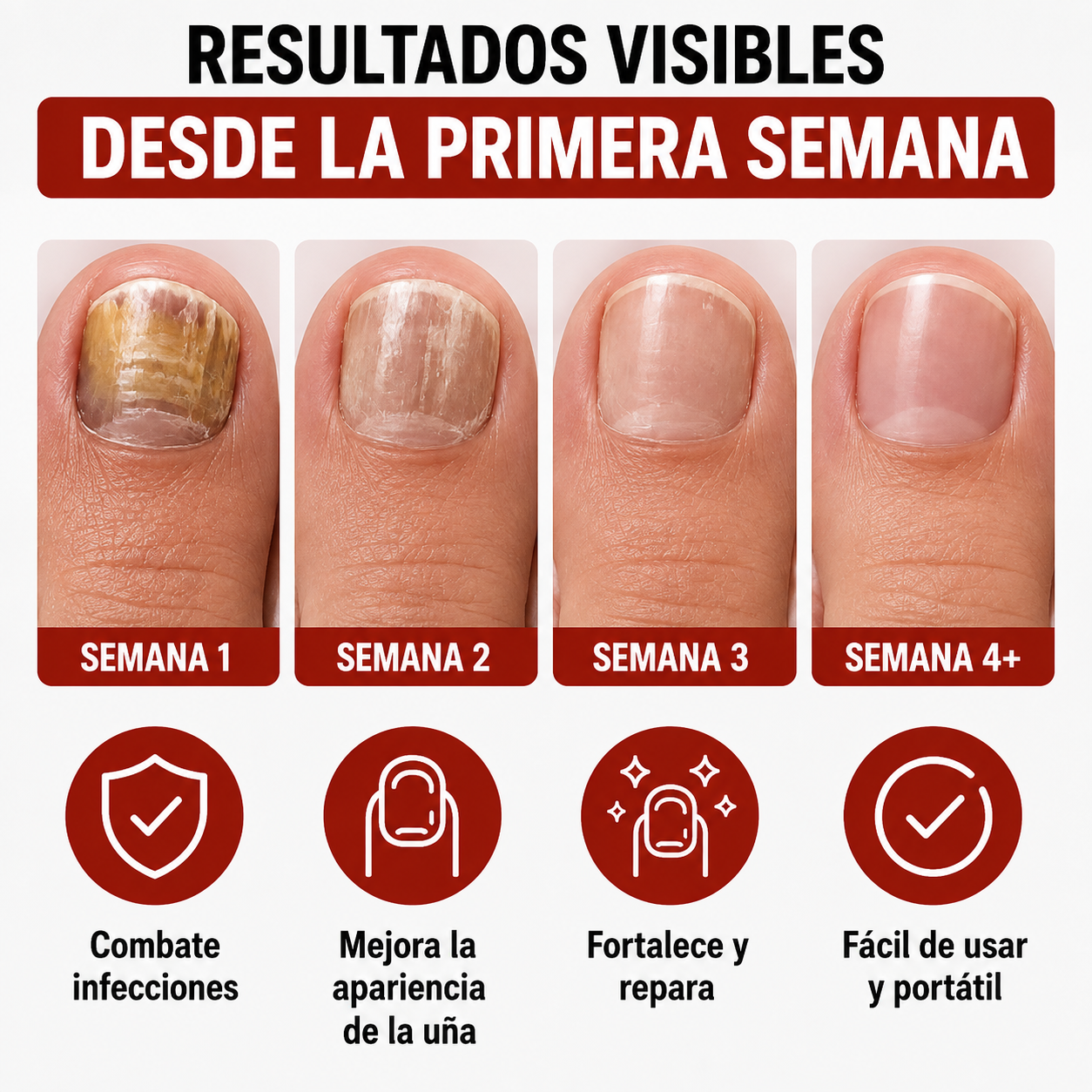 Lápiz Antihongos NailFix™