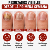 Lápiz Antihongos NailFix™
