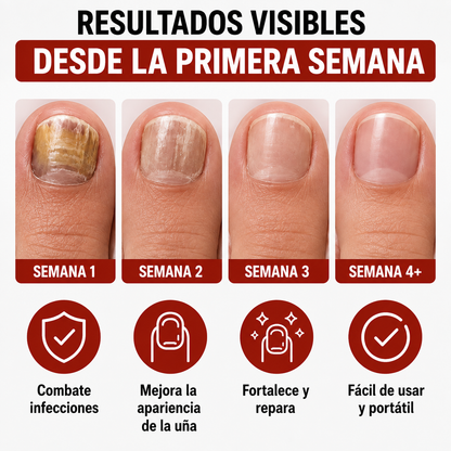 Lápiz Antihongos NailFix™