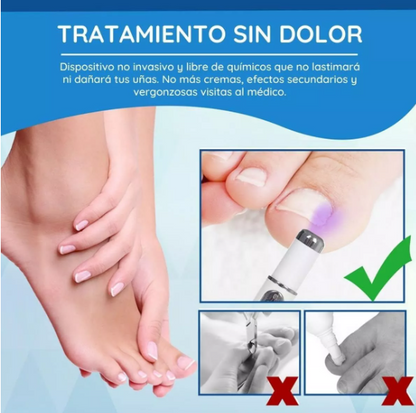 Kit Laser Silk Feet Nail + Parches