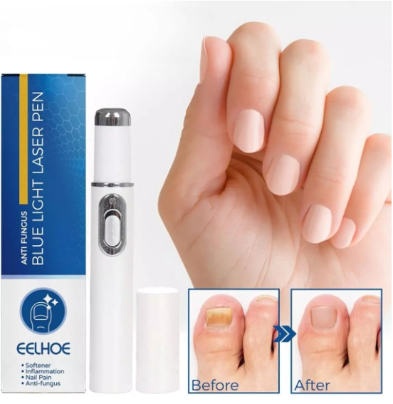 Kit Laser Silk Feet Nail + Parches