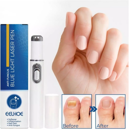 Kit Laser Silk Feet Nail + Parches